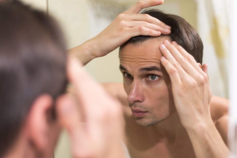 Male Pattern Hair Loss: Clinical Mechanisms, Genetic Drivers, and Proven Therapies