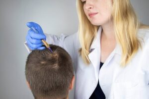 Alopecia: Medical & Therapeutic